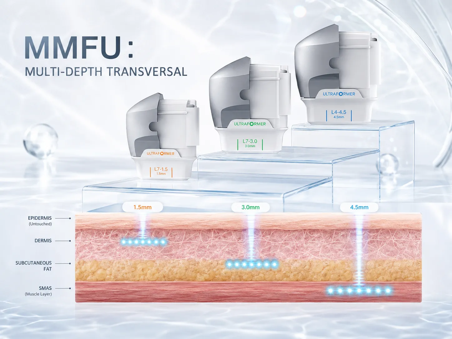 HIFU (Ultraformer III)