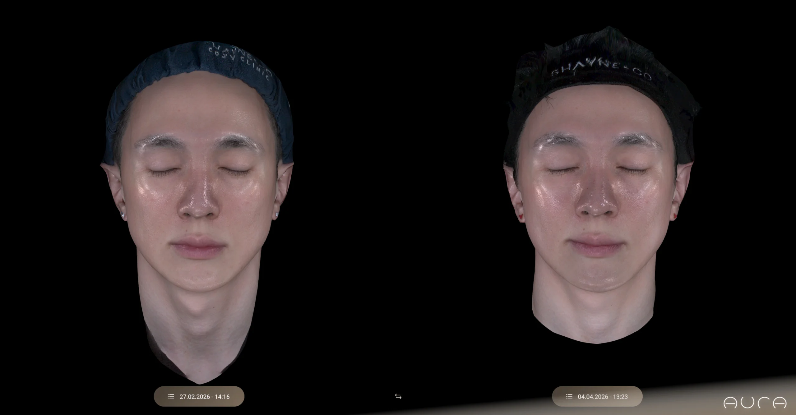 Skin Insight 360 mapping 6