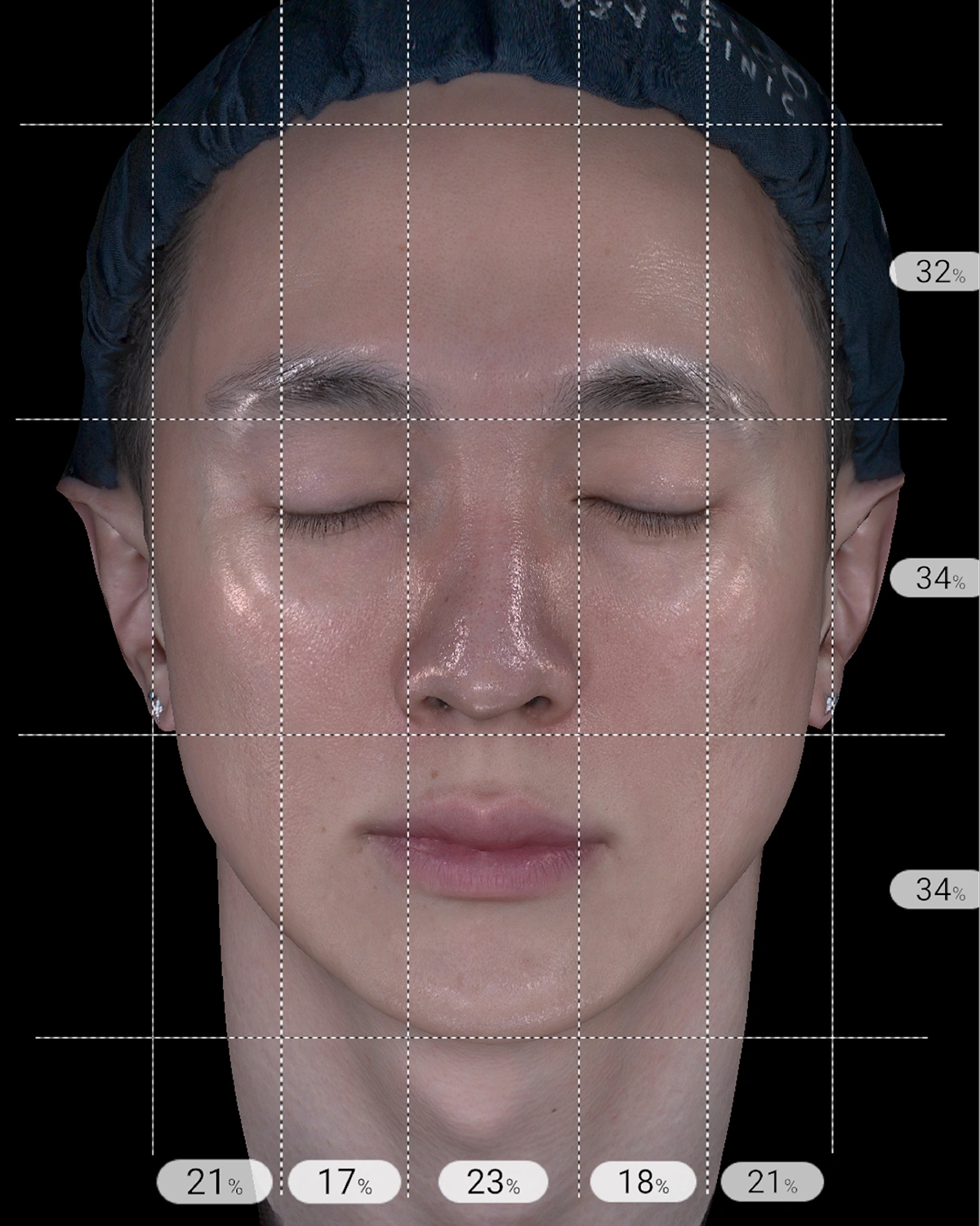 Subsurface pigment and vascular mapping detail