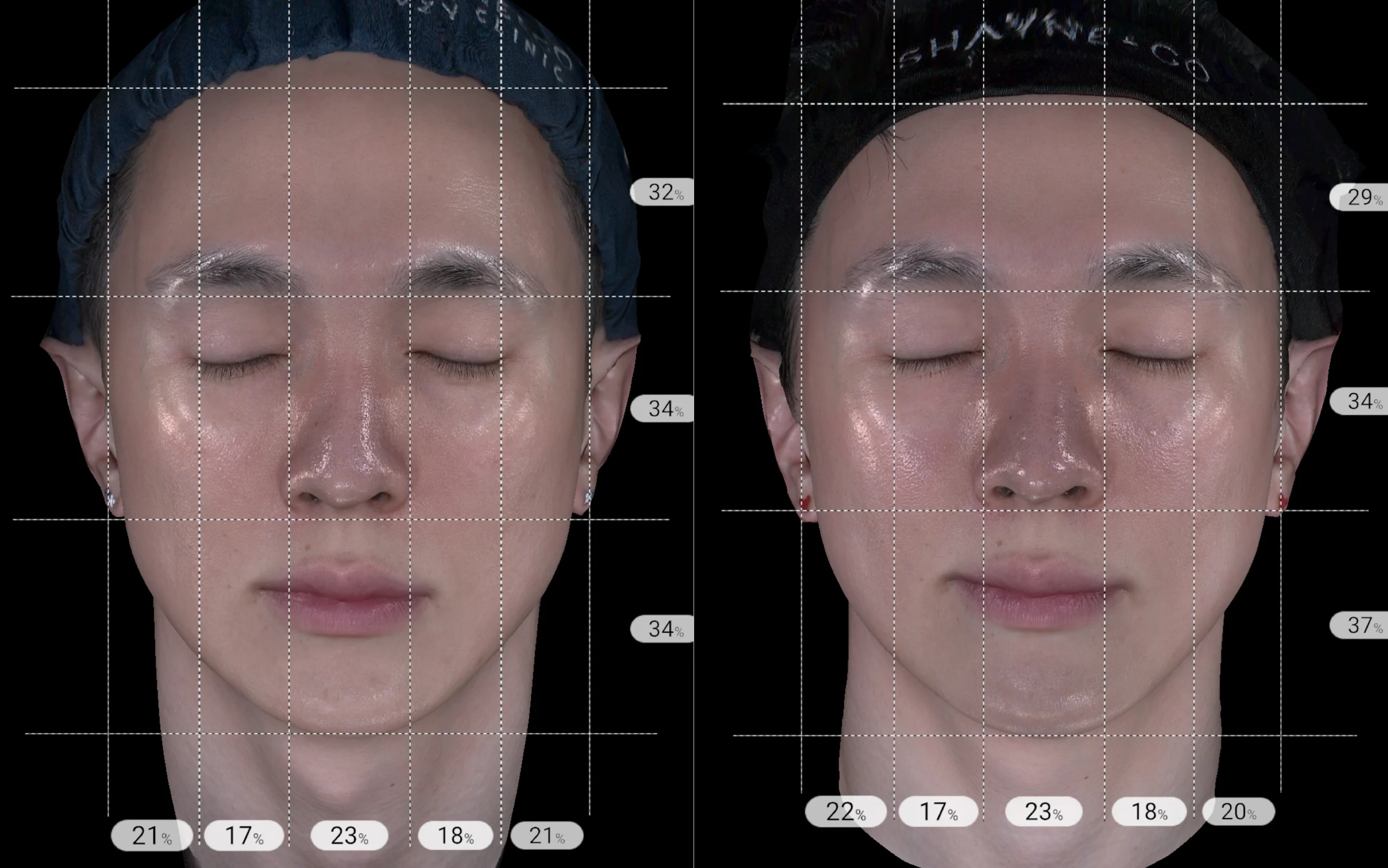 Skin Insight 360 diagnostic imaging