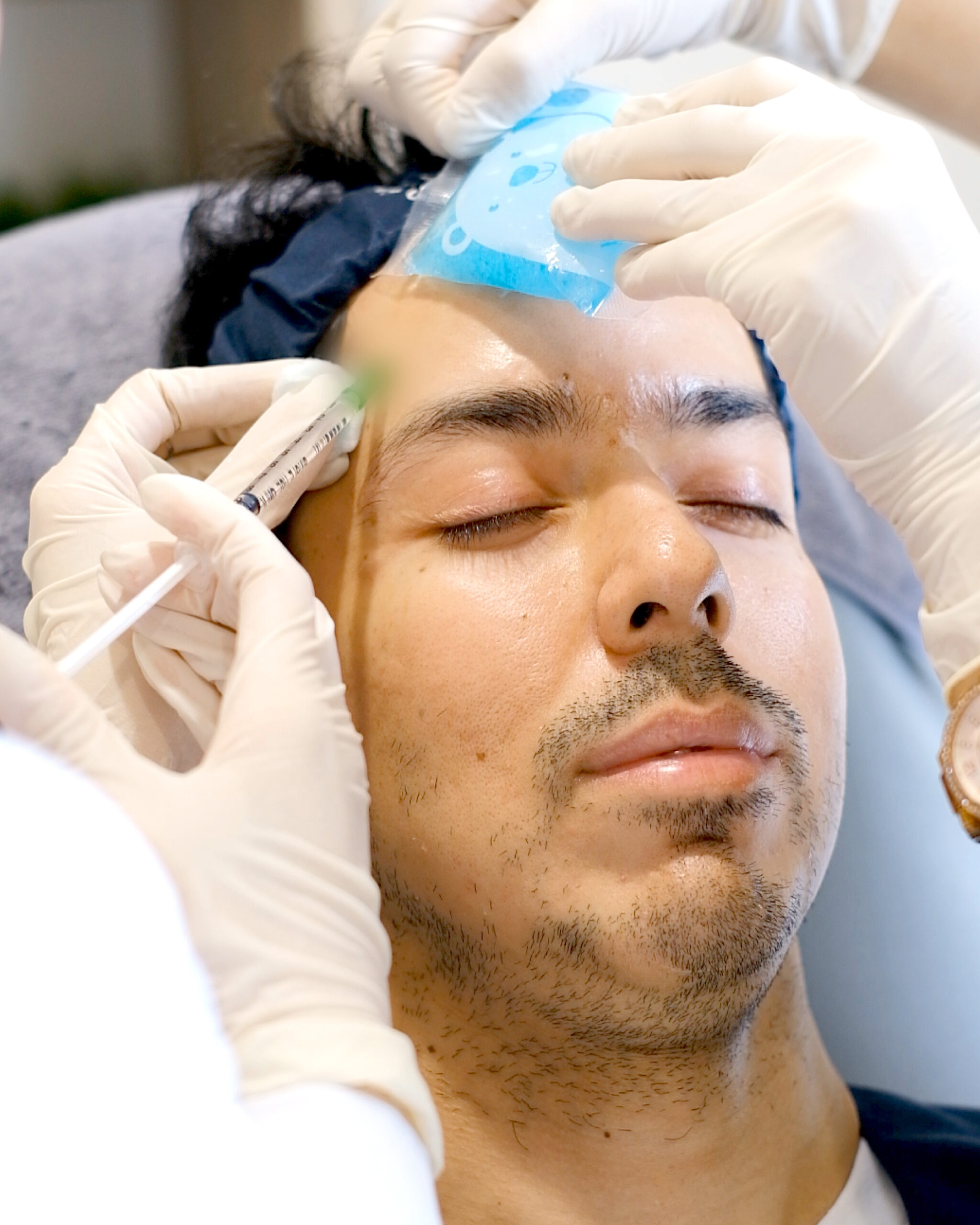 Botulinum Toxin
